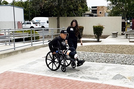 amputee patient