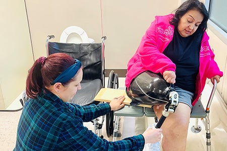 amputee patient