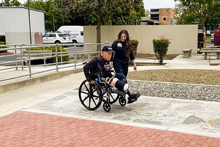 amputee patient